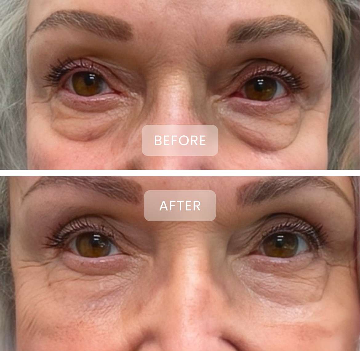 before and after treatment