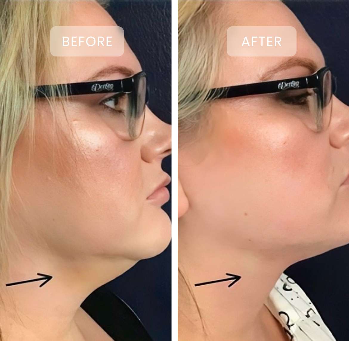 before and after treatment