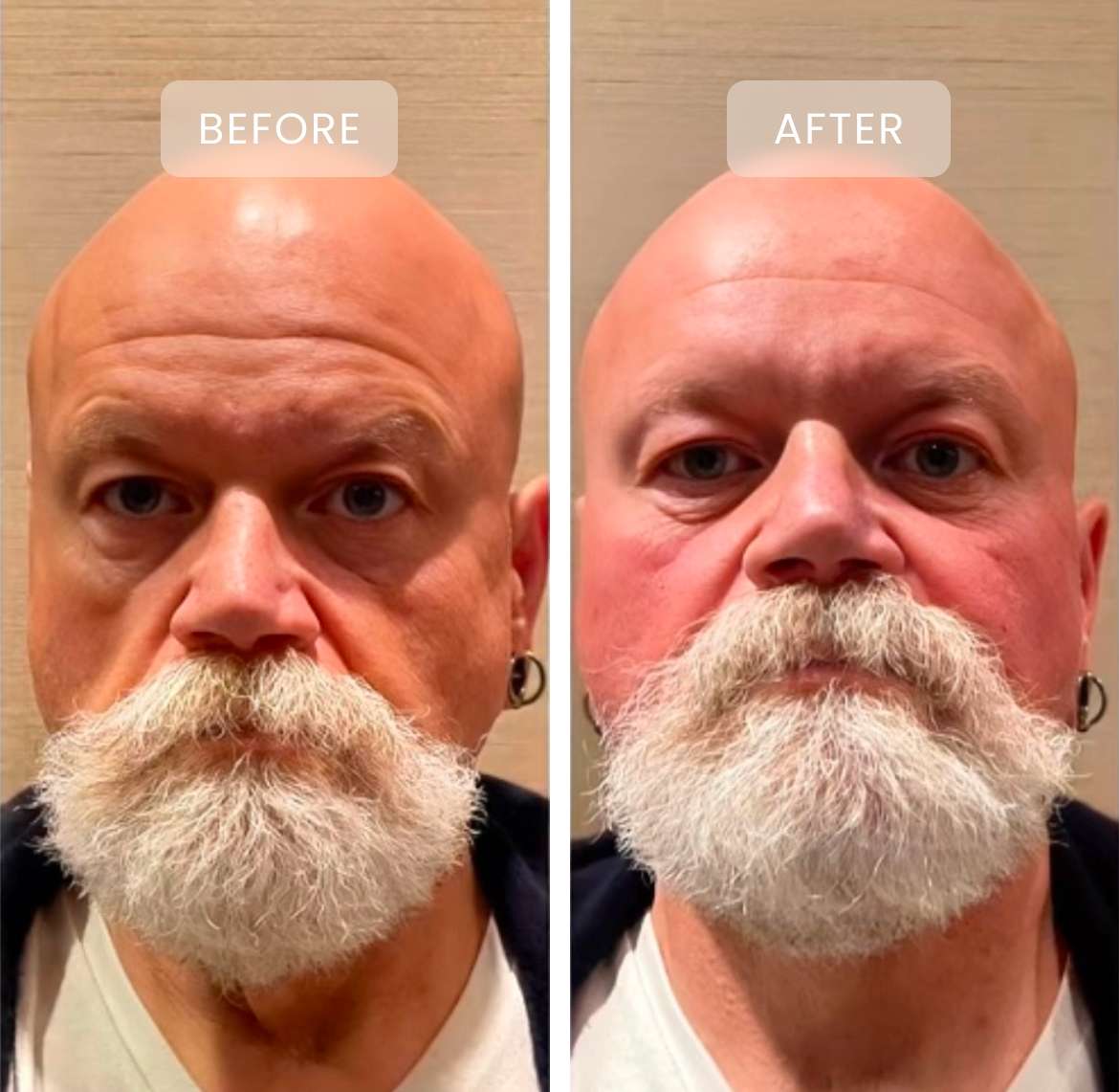 before and after treatment