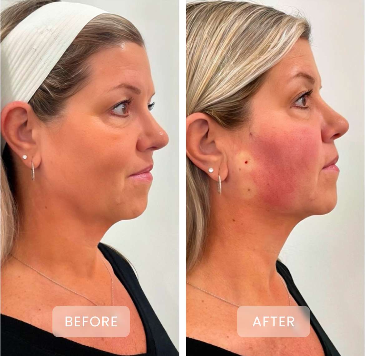 before and after treatment