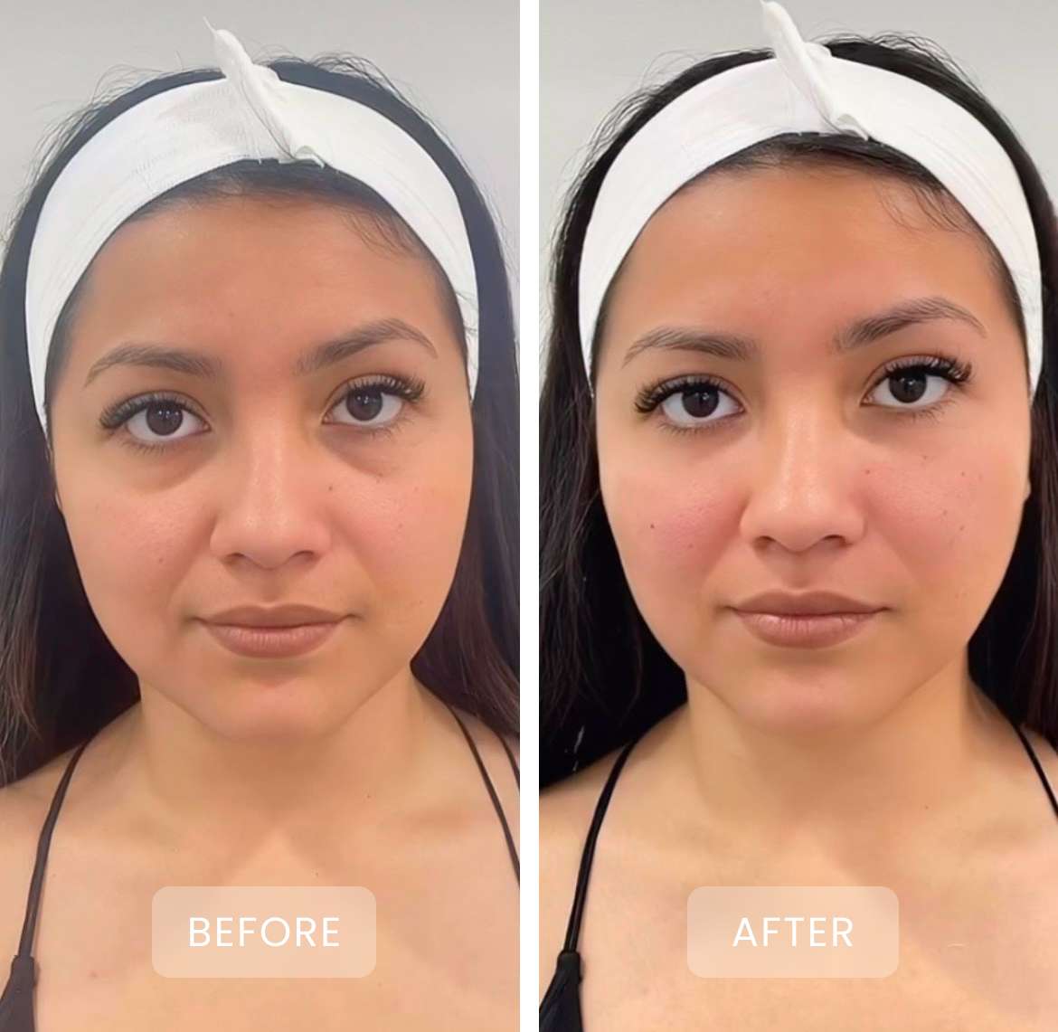 before and after treatment