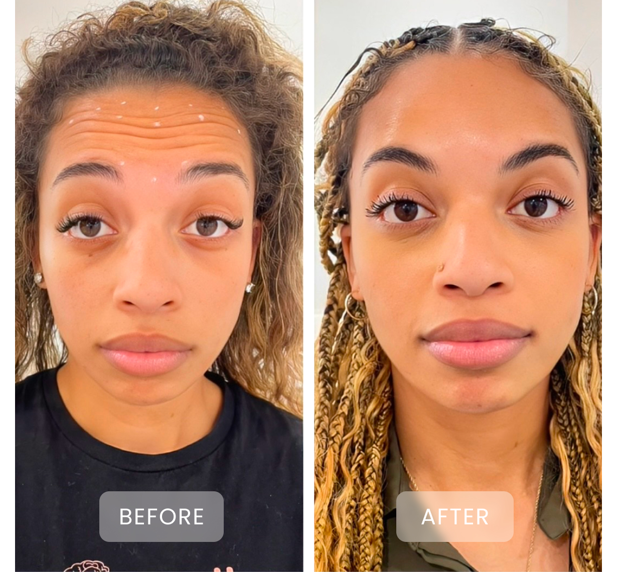 before and after treatment