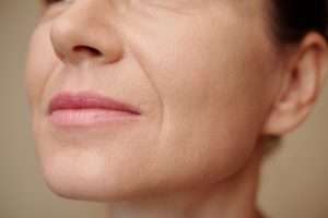 Nasolabial folds lines in woman