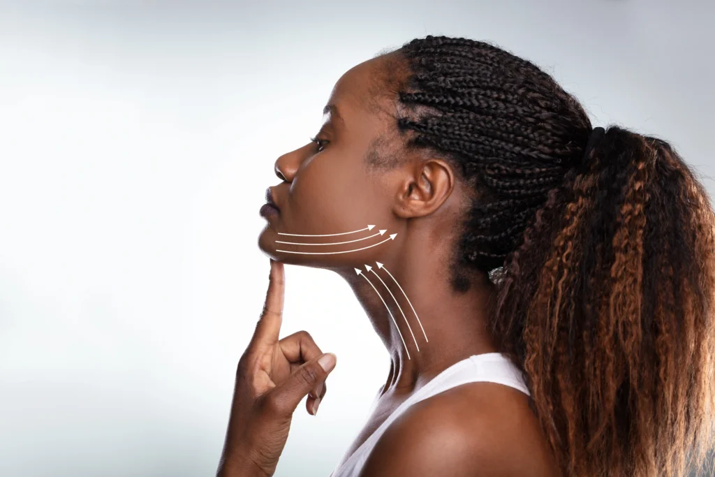 Side profile of a woman pointing to her jawline with lifting arrows drawn on her neck and chin, visually representing aesthetic improvement and the benefits related to pdo thread facelift cost.