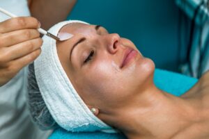 Client receiving a professional chemical peel treatment at Skin Social in Sandy Springs, GA, representing the start of proper chemical peel aftercare for glowing, rejuvenated skin.